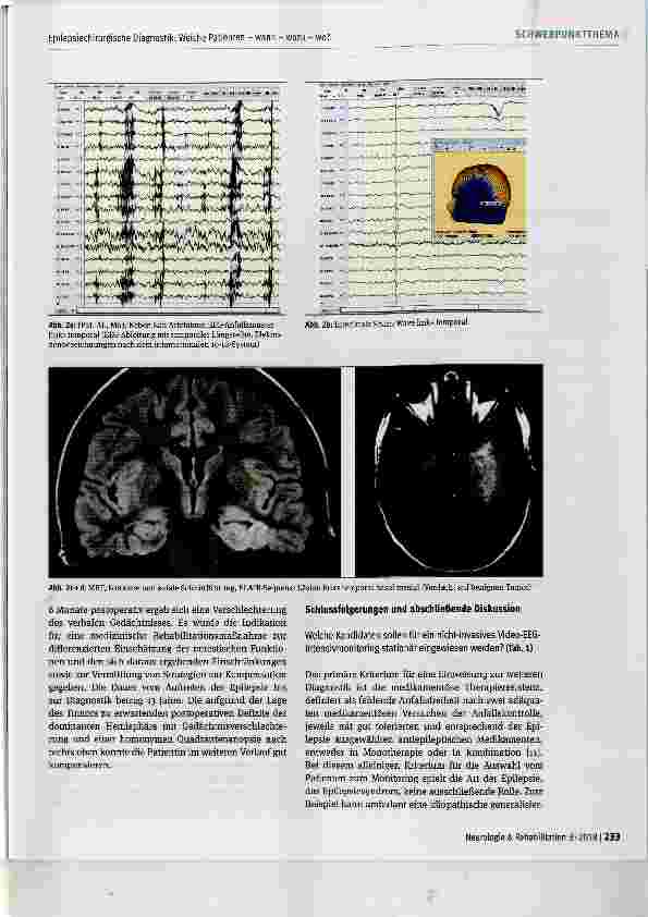 Vorschauseite 4: Epilepsiechirurgische Diagnostik: Welche Patienten wann wozu wo?