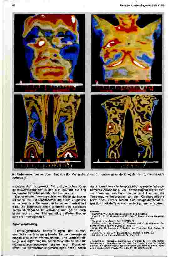 Vorschauseite 4: Thermographische Untersuchungsmethoden