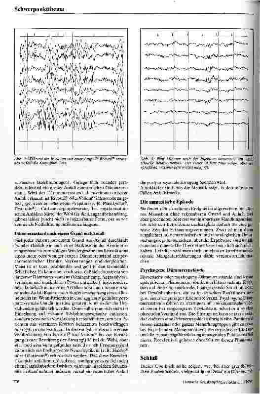 Vorschauseite 4: Der Dämmerzustand Neurologisch-psychiatrische Notsituationen