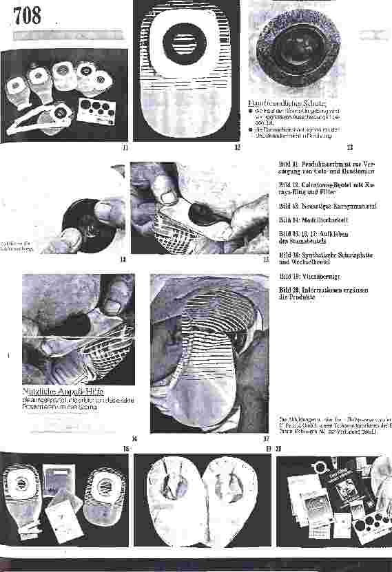 Vorschauseite 4: Spezielle Pflege: Patientenorientierte Stomatherapie / Postoperative Pflege u.Anleitung v. Betroffenen durch Alten-u.Gemeindepflegepersonen