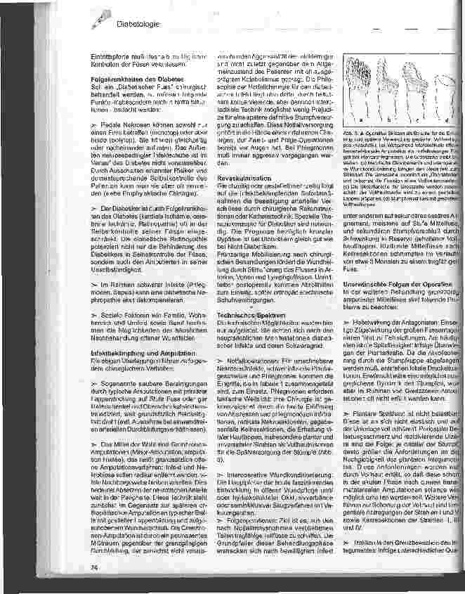 Vorschauseite 2: Der diabetische Fuß aus chirurgischer Sicht Wieviel Fuß ist besser als gar keiner?