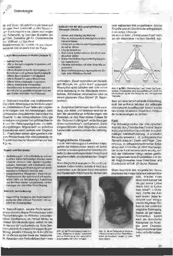 Vorschauseite 3: Der diabetische Fuß aus chirurgischer Sicht Wieviel Fuß ist besser als gar keiner?