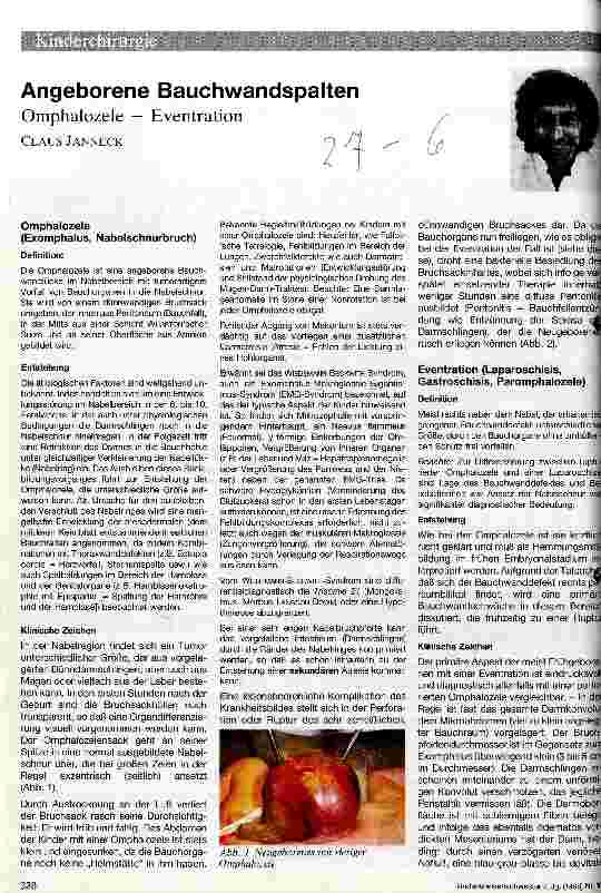 Vorschauseite 1: Angeborene Bauchwandspalten Omphalozele - Eventration