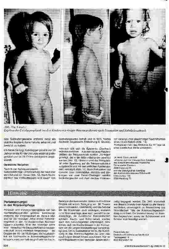 Vorschauseite 6: Angeborene Bauchwandspalten Omphalozele - Eventration