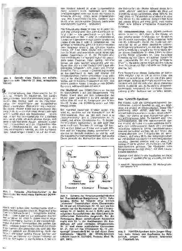 Vorschauseite 2: Kinderheilkunde 4. Folge: Krankheiten durch Chromosomen-Anomalien