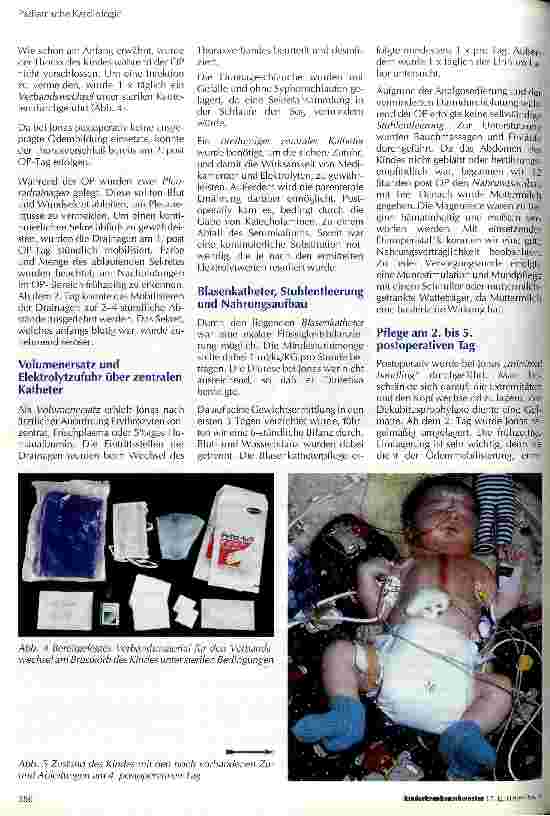 Vorschauseite 4: Präund postoperative Pflege nach Korrektur einer Transposition der großen Arterien