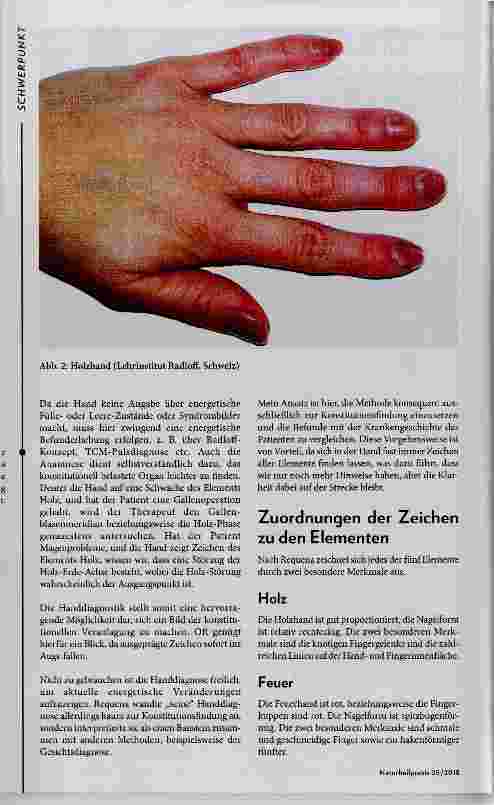 Vorschauseite 2: Chinesische Handdiagnose