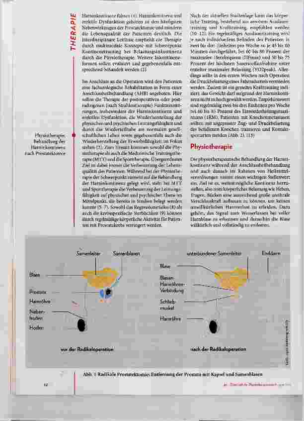 Vorschauseite 3: Männliche Harninkontinenz
