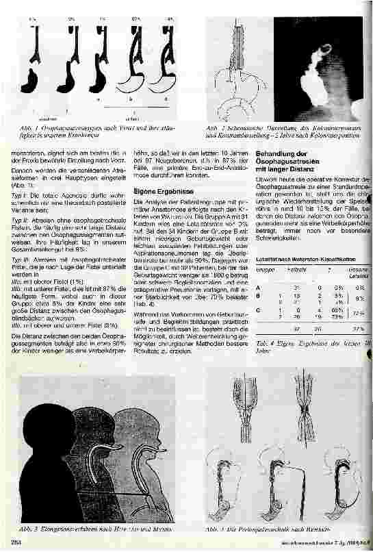 Vorschauseite 2: Ösophagusatresie Heutiger Stand der chirurgischen Behandlung