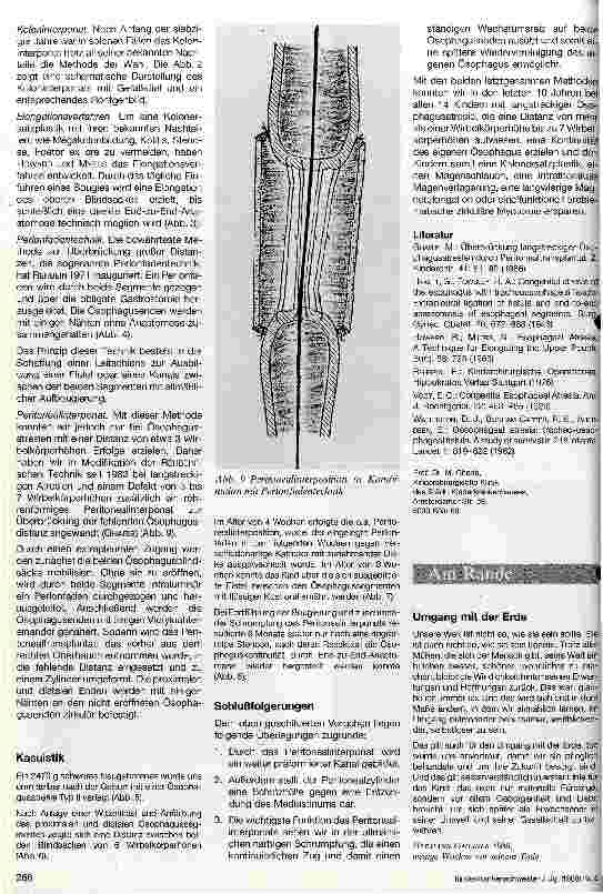 Vorschauseite 4: Ösophagusatresie Heutiger Stand der chirurgischen Behandlung