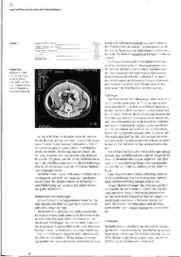 Vorschauseite 2: Palliative Therapie des Ileus bei Krebspatienten