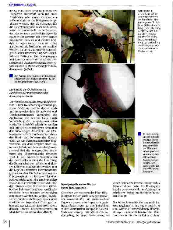 Vorschauseite 3: Bewegungsfixateure