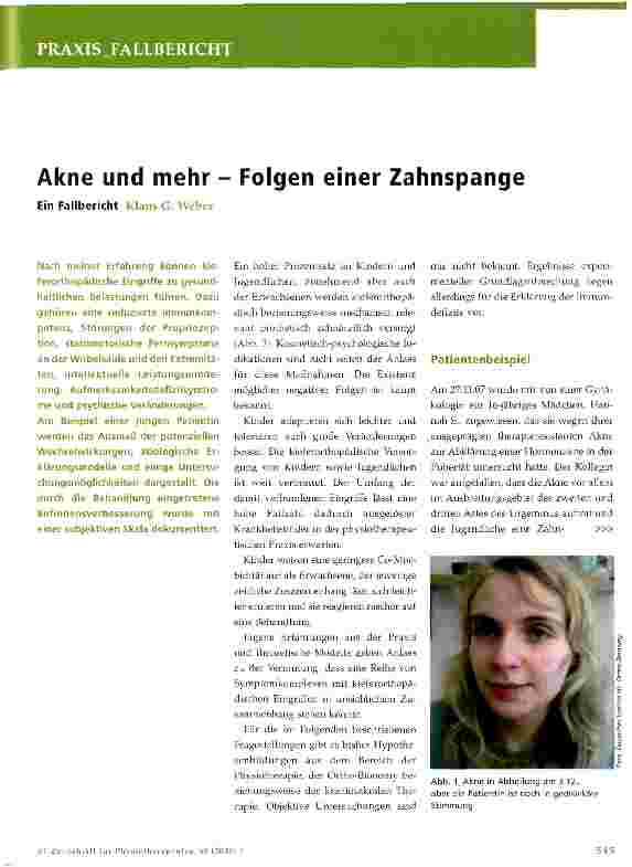Vorschauseite 1: Akne und mehr - Folgen einer Zahnspange