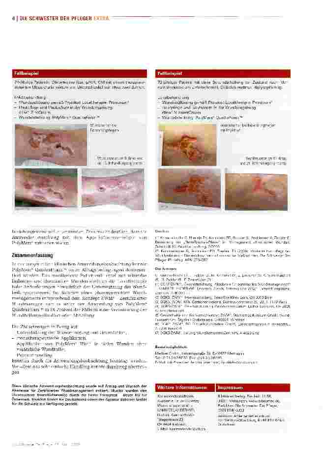 Vorschauseite 4: PolyMem® QuadraFoam™ verkürzt die Heilungszeit bei sekundär heilenden und chronischen Wunden