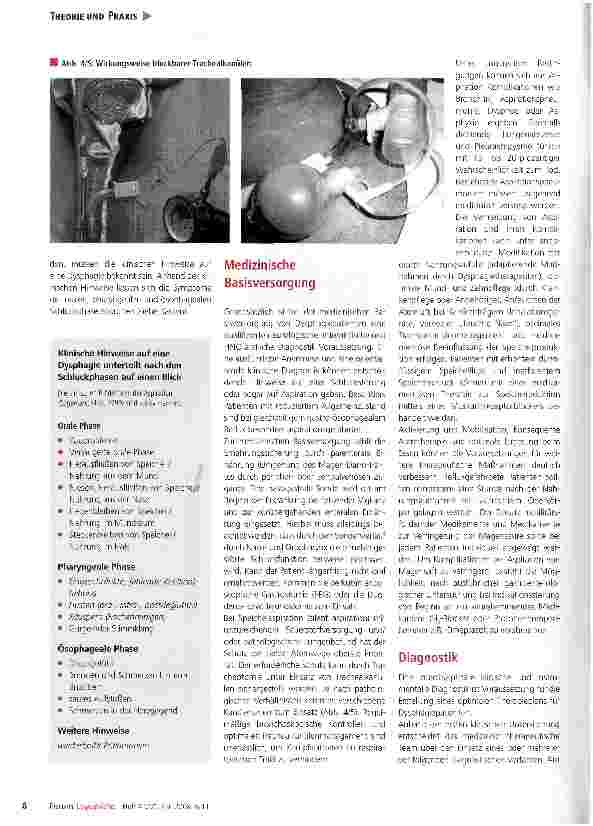 Vorschauseite 3: Strukturierte Diagnostik und evidenzbasiertes Vorgehen bei Schluckstörungen