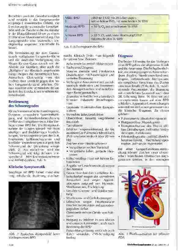 Vorschauseite 2: Bronchopulmonale Dysplasie (BPD)