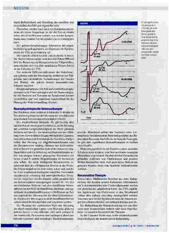 Vorschauseite 3: Hinteres Tarsaltunnelsyndrom