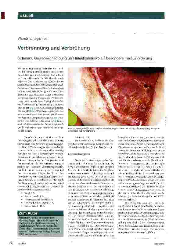 Vorschauseite 1: Verbrennung und Verbrühung Schmerz, Gewebeschädigung und Infektionsrisiko als besondere Herausforderung