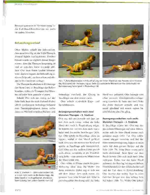Vorschauseite 5: Physiotherapie bei neurologisch bedingten Bewegungsstörungen im KindesalterBehandlungsverlauf eines Kindes mit bestehender spastischer Diparese von achtzehn Monaten bis zum achten…