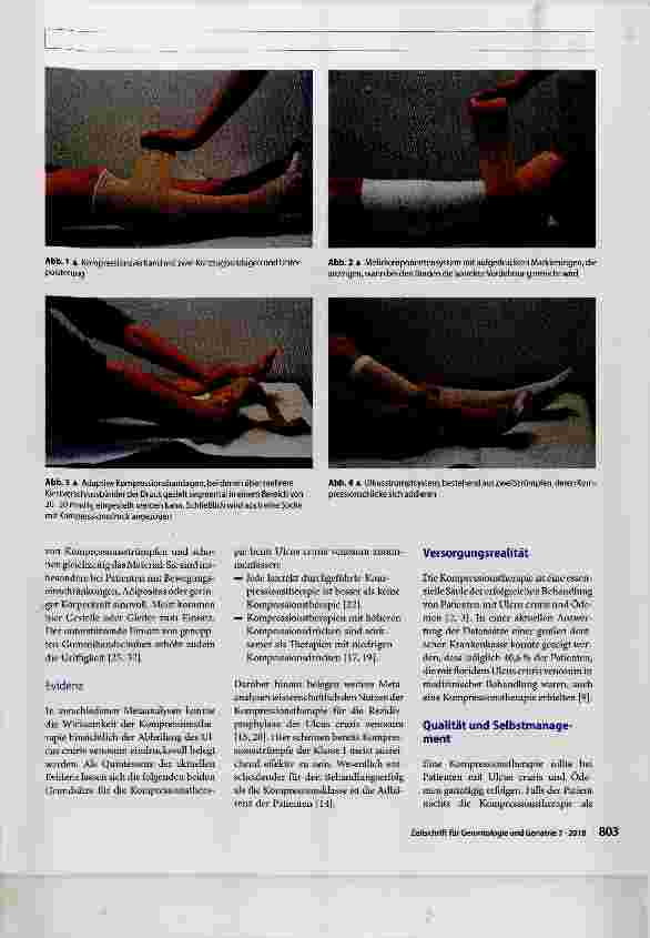 Vorschauseite 5: Kompressionstherapie des chronischen Ulcus cruris