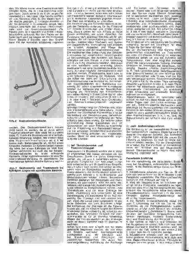 Vorschauseite 3: Ausbildung und Aufgaben der Schwestern auf Intensivpflege-Abteilungen 26. Folge: Kinderchirurgie