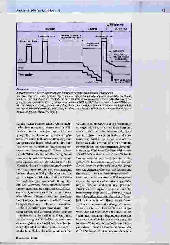 Vorschauseite 2: Automatisierte PEEP-Titration und Beatmung