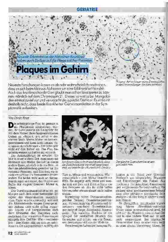 Vorschauseite 1: Plaques im Gehirn // Neuste Erkenntnisse der Alzheimer-Krankheit haben auch Einfluß auf die Pflege solcher Patienten
