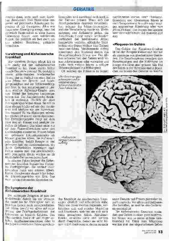 Vorschauseite 2: Plaques im Gehirn // Neuste Erkenntnisse der Alzheimer-Krankheit haben auch Einfluß auf die Pflege solcher Patienten