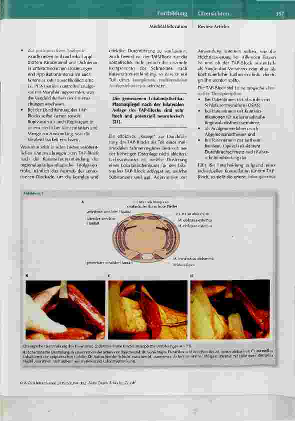 Vorschauseite 4: Schmerztherapie nach Sectio