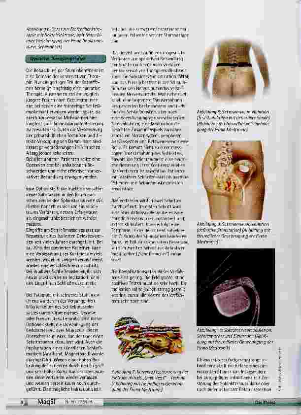 Vorschauseite 5: Stuhlinkontinenz Diagnostik und Therapie