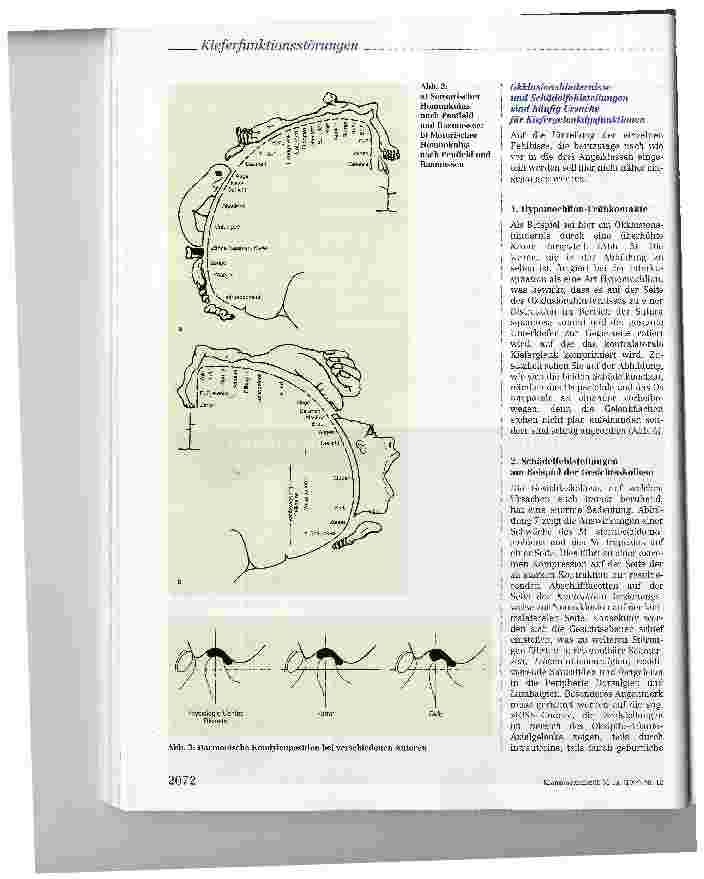 Vorschauseite 5: Kieferfunktionsstörungen und Zahnfehlstellungen mit ihren Auswirkungen auf die Körperperipherie