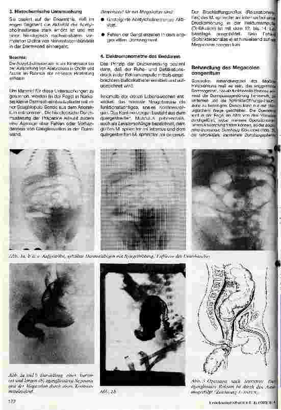 Vorschauseite 2: Megacolon congenitum