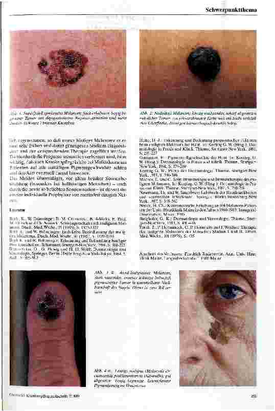 Vorschauseite 3: Klinik des malignen Melanoms