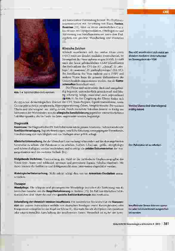 Vorschauseite 5: Ulcus cruris beim alten Patienten