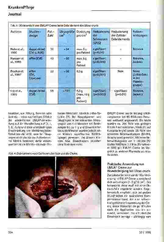 Vorschauseite 3: Einsatz von EMLA (r) Creme bei Ulcus cruris: Nutzen und Grenzen