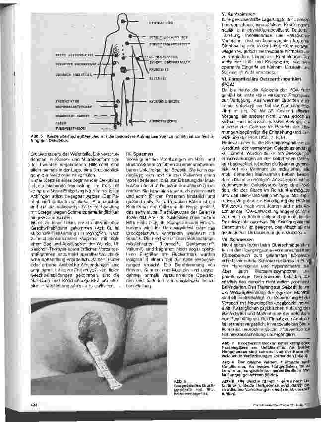 Vorschauseite 3: Behandlung und Prophylaxe von Komplikationen und Spätfolgen Die Rehabilitation traumatisch Querschnittgelähmter 6. Folge