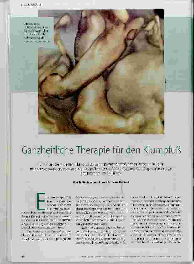 Vorschauseite 1: Ganzheitliche Therapie für den Klumpfuß