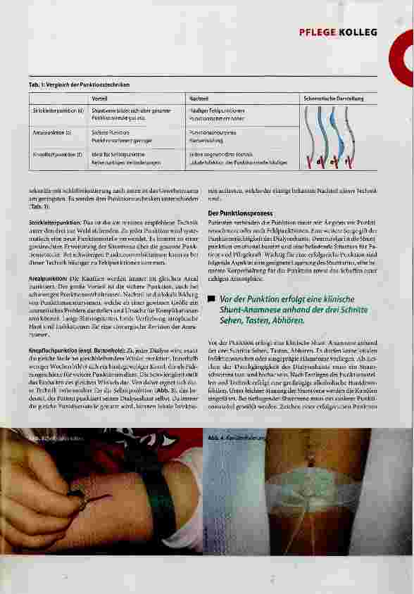 Vorschauseite 2: Dialyseshunt- Punktion und Nachsorge