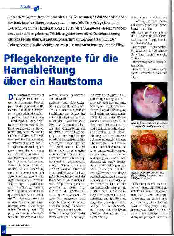 Vorschauseite 1: Pflegekonzepte für die Harnableitung über ein Hautstoma