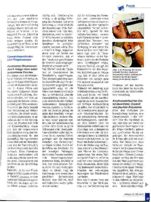 Vorschauseite 2: Pflegekonzepte für die Harnableitung über ein Hautstoma