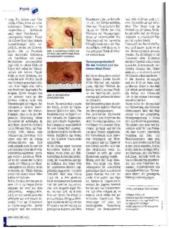 Vorschauseite 3: Pflegekonzepte für die Harnableitung über ein Hautstoma