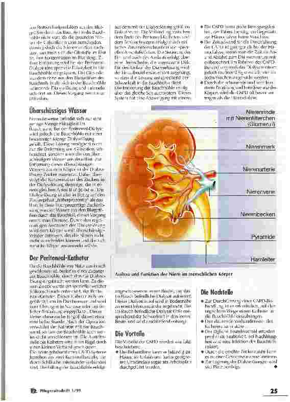 Vorschauseite 2: Wenn das Bauchfell als natürlicher Filter dient. Möglichkeiten und Grenzen der Peritoneal-Dialyse