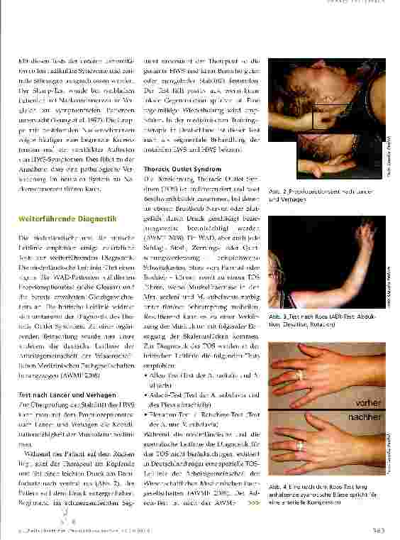 Vorschauseite 3: Whiplash Associated Disorder (WAD) -physiotherapeutische Untersuchung