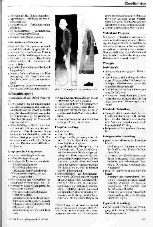 Vorschauseite 3: Osteoporose - eine Alterserkrankung Präventive Maßnahmen und pflegerische Aspekte