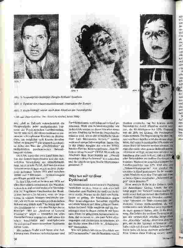 Vorschauseite 3: Neue Seuche: Tardive Dyskinesie Am Wendepunkt der psychiatrischen Psychopharmakologie?