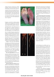 Vorschauseite 3: Klassifikationen der peripheren arteriellen Verschlusskrankheit