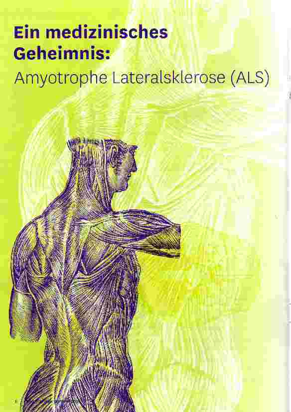 Vorschauseite 1: Ein medizinisches Geheimnis: Amyotrophe Lateralsklerose (ALS)