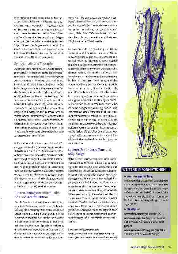 Vorschauseite 4: Ein medizinisches Geheimnis: Amyotrophe Lateralsklerose (ALS)