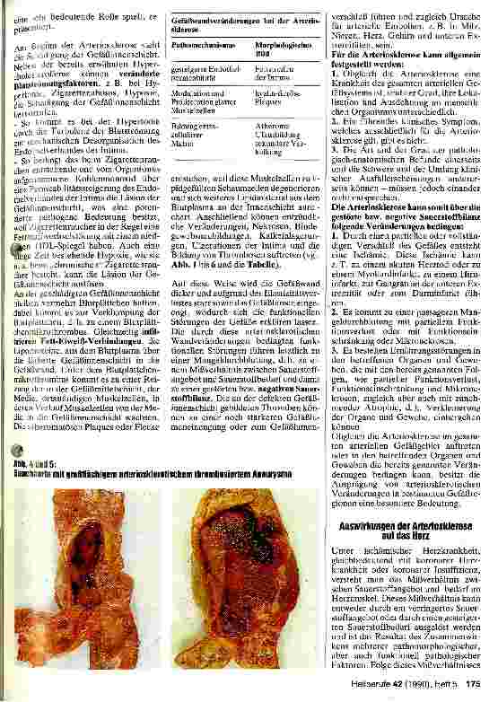 Vorschauseite 2: Arteriosklerose - ihre Ursachen und Folgen
