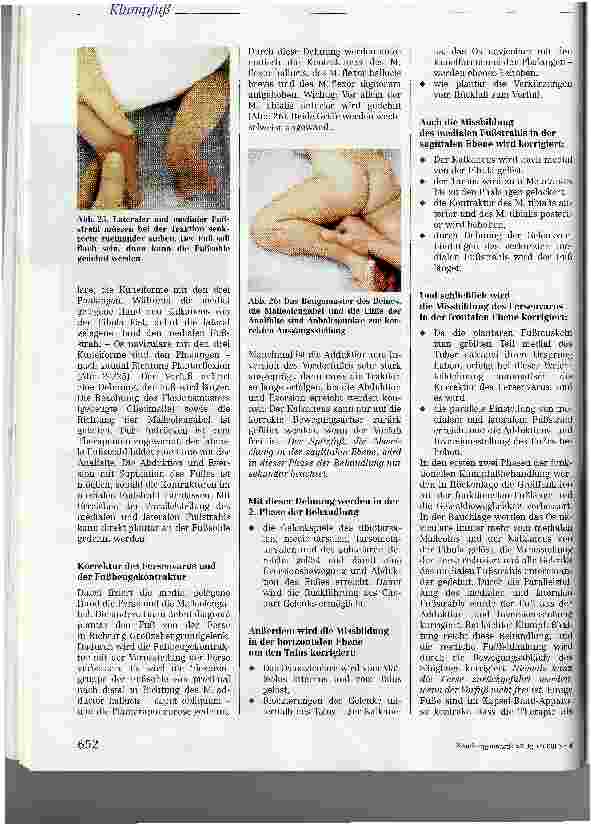 Vorschauseite 6: Der Säuglingsklumpfuß: Funktionelle, dreidimensionale manuelle Fußtherapieauf neurophysiologischer Grundlage (Teil II)